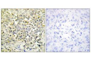 Immunohistochemistry (IHC) image for anti-Cyclin-Dependent Kinase-Like 4 (CDKL4) (C-Term) antibody (ABIN1849692) (CDKL4 antibody  (C-Term))