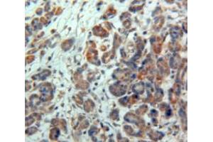 Used in DAB staining on fromalin fixed paraffin-embedded Pancreas tissue (NPTX2 antibody)