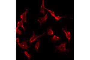 ABIN6277981 staining Hela by IF/ICC. (PRKAR2B antibody  (Internal Region))
