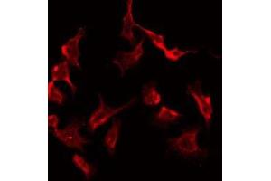 ABIN6277981 staining Hela by IF/ICC. (PRKAR2B antibody  (Internal Region))