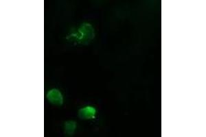 Image no. 1 for anti-Amyloid P Component, Serum (APCS) antibody (ABIN1500898) (APCS antibody)