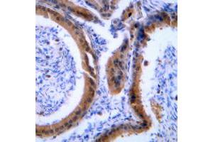 Immunohistochemical analysis of VASP staining in human tonsil formalin fixed paraffin embedded tissue section. (VASP antibody  (Center))
