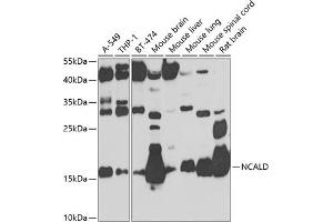 Western blot analysis of extracts of various cell lines, using NCALD antibody (ABIN6132891, ABIN6144390, ABIN6144391 and ABIN6224019) at 1:1000 dilution. (NCALD antibody  (AA 1-193))