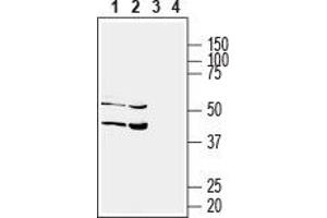 Western blot analysis of human HT-29 colorectal adenocarcinoma (lanes 1 and 3) and human HepG2 liver hepatome (lanes 2 and 4) cell lysates: - 1,2. (Solute Carrier Family 17 (Acidic Sugar Transporter), Member 5 (SLC17A5) (AA 479-492), (C-Term), (Intracellular) antibody)