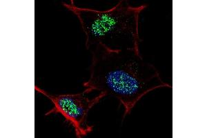 Fluorescent confocal image of SY5Y cells stained with f KLF4  antibody.