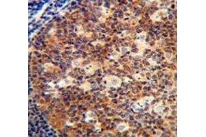 IL-12B antibody immunohistochemistry analysis in formalin fixed and paraffin embedded human tonsil tissue. (IL12B antibody  (AA 264-290))