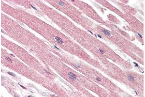 Human Heart (formalin-fixed, paraffin-embedded) stained with CASP1 antibody ABIN461892 at 5 ug/ml followed by biotinylated goat anti-rabbit IgG secondary antibody ABIN481713, alkaline phosphatase-streptavidin and chromogen. (Caspase 1 antibody)
