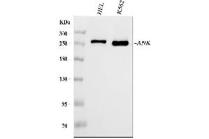 Western blot analysis of Ankyrin erythroid/ANK/ANK1 using anti-Ankyrin erythroid/ANK/ANK1 antibody (ABIN7599958).