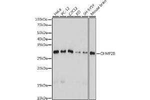 Western blot analysis of extracts of various cell lines, using CHMP2B antibody (ABIN7266290) at 1:1000 dilution. (CHMP2B antibody)