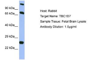 Host: Rabbit Target Name: TBC1D7 Sample Type: Fetal Brain lysates Antibody Dilution: 1.