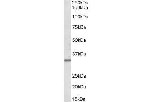 ABIN1590100 (0. (Caspase 6 antibody  (Internal Region))