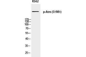Western Blotting (WB) image for anti-Ataxia Telangiectasia Mutated (ATM) (pSer1981) antibody (ABIN5955782) (ATM antibody  (pSer1981))