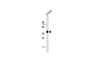 Anti-AGXT Antibody (Center)at 1:2000 dilution + human liver lysates Lysates/proteins at 20 μg per lane. (AGXT antibody  (AA 96-125))