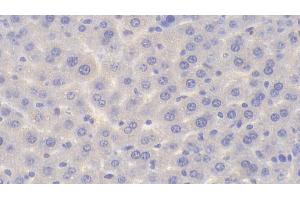 Immunohistochemistry (IHC) image for anti-Phosphorylase, Glycogen, Muscle (PYGM) (AA 11-187) antibody (ABIN7432742)