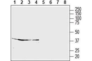 Western blot analysis of rat cortex (lanes 1 and 5), rat cerebellum (lanes 2 and 6), rat hippocampus (lanes 3 and 7) and mouse brain (lanes 4 and 8) lysates: - 1-4. (S1PR5 antibody  (Extracellular, N-Term))