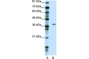 Western Blotting (WB) image for anti-Zinc Finger Protein 444 (ZNF444) antibody (ABIN2461893) (ZNF444 antibody)