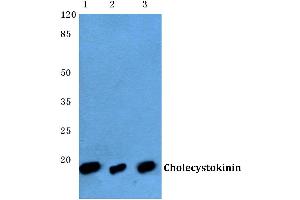 Western blot (WB) analysis of CCK antibody at 1/500 dilution