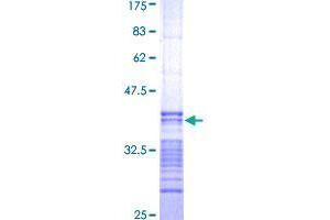 STK26/MST4 Protein (AA 1-90) (GST tag)