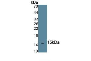 Detection of Recombinant IL18, Human using Monoclonal Antibody to Interleukin 18 (IL18) (IL-18 antibody  (AA 94-193))