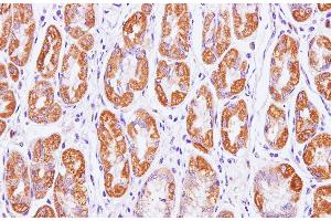 Immunohistochemistry of paraffin-embedded Human stomach using Cytochrome c1 Polyclonal Antibody at dilution of 1:100(400x) (Cytochrome C1 antibody)
