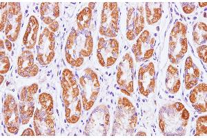 Immunohistochemistry of paraffin-embedded Human stomach using Cytochrome c1 Polyclonal Antibody at dilution of 1:100(400x)