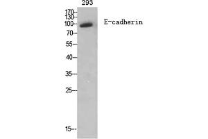 Western Blot analysis of various cells using E-cadherin Polyclonal Antibody diluted at 1:2000. (E-cadherin antibody  (AA 810-890))