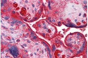 Human Placenta: Formalin-Fixed, Paraffin-Embedded (FFPE) (APOA2 antibody  (AA 1-100))