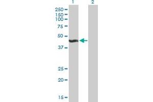 Western Blot analysis of ALG2 expression in transfected 293T cell line by ALG2 MaxPab polyclonal antibody. (ALG2 antibody  (AA 1-416))