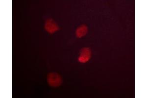Immunofluorescence (fixed cells) (IF/ICC) image for anti-Mdm2, p53 E3 Ubiquitin Protein Ligase Homolog (Mouse) (MDM2) (pSer166) antibody (ABIN6256167)