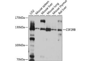 Western blot analysis of extracts of various cell lines, using CSF2RB antibody (ABIN6130049, ABIN6139098, ABIN6139099 and ABIN6214780) at 1:1000 dilution. (CD131 antibody  (AA 200-443))