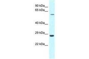 Image no. 1 for anti-Copine III (CPNE3) (C-Term) antibody (ABIN6747789) (Copine III antibody  (C-Term))