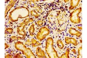 Immunohistochemistry of paraffin-embedded human kidney tissue using ABIN7155687 at dilution of 1:100 (EMX2 antibody  (AA 75-141))