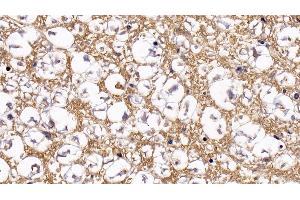 Immunohistochemistry (IHC) image for anti-Granzyme B (GZMB) (AA 21-247) antibody (ABIN7432145)