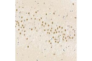 Immunohistochemistry analysis of paraffin-embedded rat brain using,HECTD1 (ABIN7074186) at dilution of 1: 2000 (HECTD1 antibody)