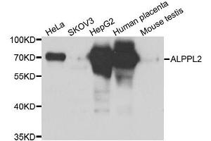 Western blot analysis of extracts of various cell lines, using ALPPL2 antibody. (ALPPL2 antibody  (AA 20-280))