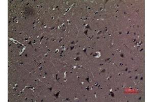 Immunohistochemistry (IHC) analysis of paraffin-embedded Human Brain, antibody was diluted at 1:100. (AAT (Internal Region) antibody)