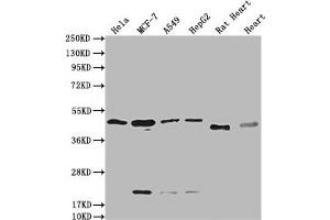 Western Blot Positive WB detected in: Hela whole cell lysate, MCF-7 whole cell lysate, A549 whole cell lysate, HepG2 whole cell lysate, Rat Heart tissue, Mouse Heart tissue All lanes: HTR3E antibody at 1:2000 Secondary Goat polyclonal to rabbit IgG at 1/50000 dilution Predicted band size: 52, 50, 53, 51, 54 kDa Observed band size: 50 kDa (HTR3E antibody  (AA 26-248))