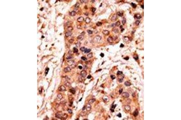 GUCY1A2 antibody  (C-Term)