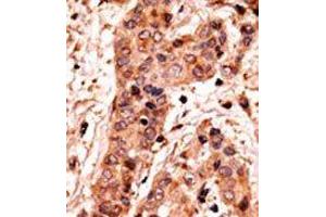 Image no. 2 for anti-Guanylate Cyclase 1, Soluble, alpha 2 (GUCY1A2) (C-Term) antibody (ABIN360707) (GUCY1A2 antibody  (C-Term))