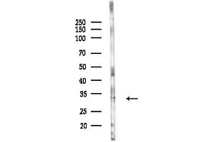 Western blot analysis of lysates from PC12 cells(LPS,4h treatment), using TSSC4 Antibody at 1/1000 dilution.