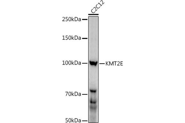 MLL5/KMT2E antibody  (AA 200-500)