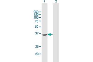 Western Blot analysis of STRADA expression in transfected 293T cell line by STRADA MaxPab polyclonal antibody. (STRADA antibody  (AA 1-348))