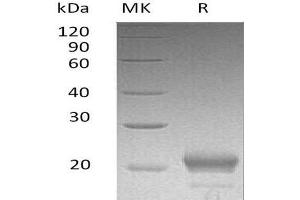 Chemokine (C-X-C Motif) Ligand 15 (CXCL15) protein (His tag)