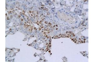 Formalin-fixed and paraffin embedded mouse lung labeled with Anti-CD57 Polyclonal Antibody, Unconjugated (ABIN732308) followed by conjugation to the secondary antibody and DAB staining (CD57 antibody  (AA 21-120))