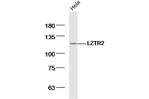 Hela lysates probed with LZTR2 Polyclonal Antibody, Unconjugated  at 1:300 dilution and 4˚C overnight incubation. (SEC16B antibody  (AA 351-450))