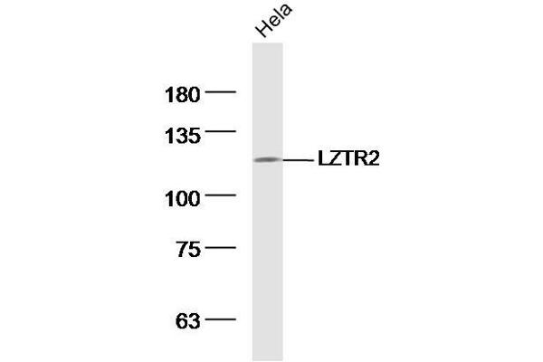SEC16B anticorps  (AA 351-450)