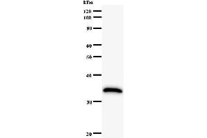 Western Blotting (WB) image for anti-Human Immunodeficiency Virus Type I Enhancer Binding Protein 1 (HIVEP1) antibody (ABIN931132) (HIVEP1 antibody)