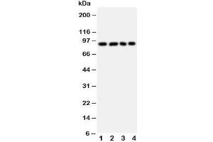 Western blot testing of IL4R antibody and Lane 1:  A431;  2: SMMC-7721;  3: U87;  4: 293T cell lysate. (IL4 Receptor antibody  (Middle Region))