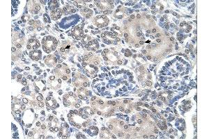 Immunohistochemistry (IHC) image for anti-Phosphoribosyl Pyrophosphate Amidotransferase (PPAT) (N-Term) antibody (ABIN2782471) (PPAT antibody  (N-Term))