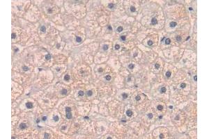 DAB staining on IHC-P; Samples: Human Liver Tissue (PLGF antibody  (AA 43-162))
